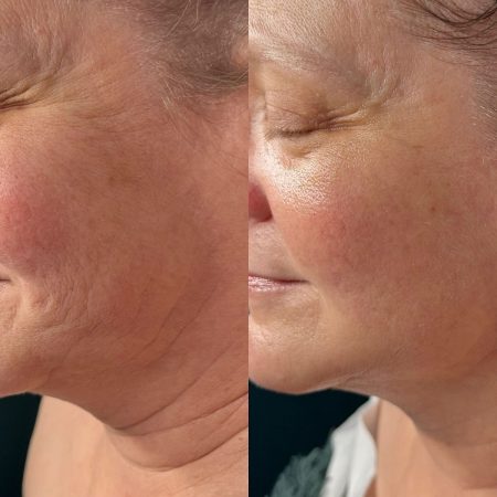 50ac51bd371026db2e6c7a9051227342